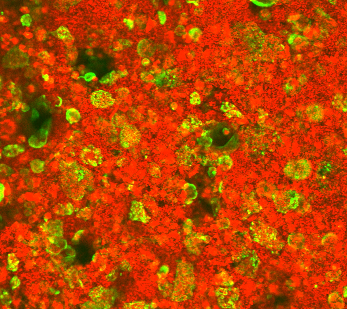 Osteoclasts timelapse on P3D Scaffolds