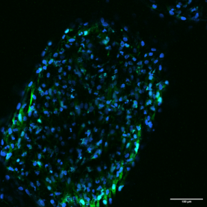 cell distribution on scaffold