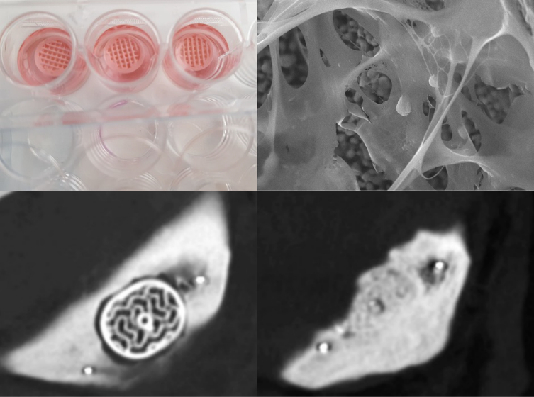 3D scaffolds for regenerative medicine