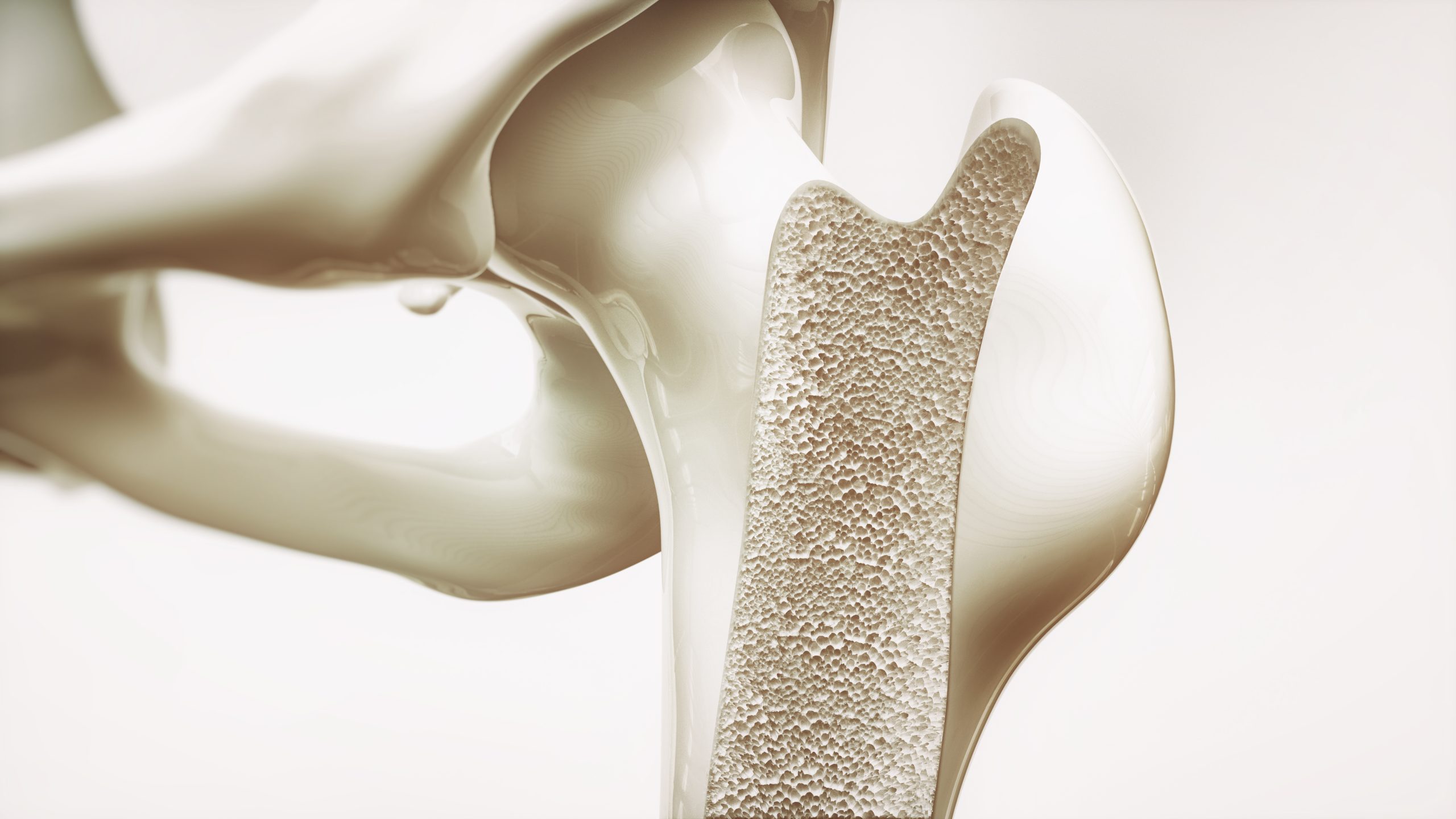 Illustration: Close up of femur.